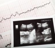 Fetal Monitoring: The Beeping Machine Revealing Info About Your Child's Delivery