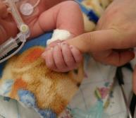 Birth Complications and Cerebral Palsy