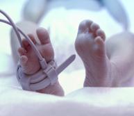 NICU Errors Can Result in a Cerebral Palsy Diagnosis